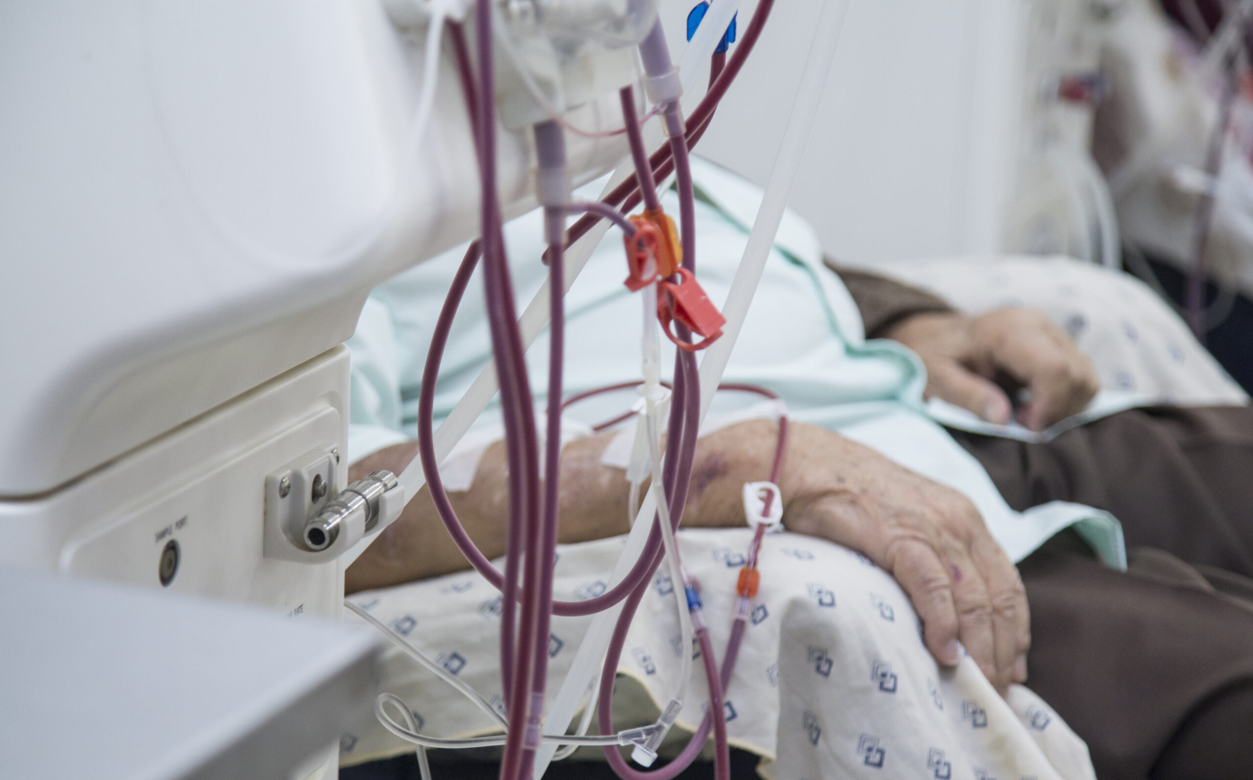 hemodialysis in people on the equipment